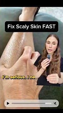 Dermatologist Reacts to EXTREME Dry Skin
