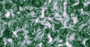 Microscope virus, bacteria and zoom of particles moving slowly in experiment on a white background. Microscopic organisms in DNA healthcare of green cells, microbiology health cure for micro germs.