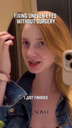 Uneven eyes… but make it ✨non-surgical✨ #Ultherapy #HIFUKorea #NonSurgicalLift #UnevenEyesFix