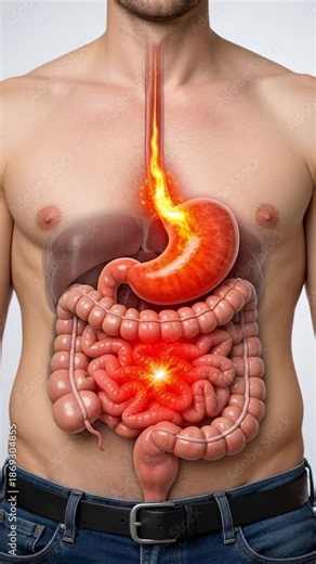 Gerd medical stomach pain digestive system human torso acid reflux burning sensation heartburn illustration anatomy concept male torso digestive system gerd acid reflux inflammation intestine