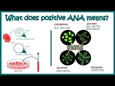 ANA test positive means ? | Antinuclear Antibody Test (ANA) procedure |‪@wellnessbuddy‬