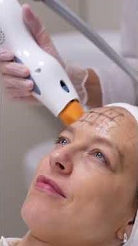 Thermage : Smooth, tighten and contour for younger-looking appearance