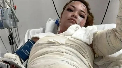 Mum, 24, dies in hot tub accident with entire body scalded after passing out