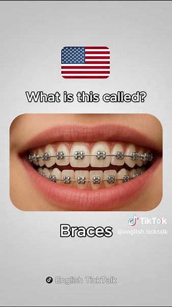 Learn English: Tooth Edition Vocabulary