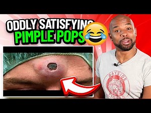 Disgusting But Satisfying Pimple Zit Popping Compilation Part 10