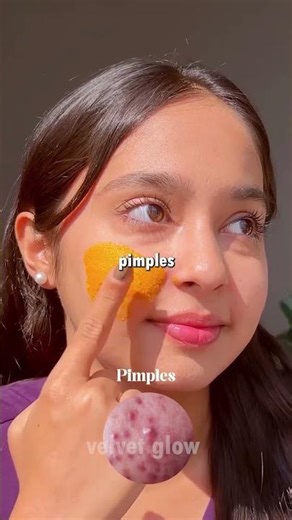 Vaseline Beauty Hacks 😍 Dark Circles, Pimples & Pink Lips Naturally
