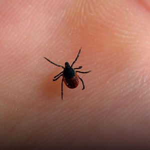 Take on tick season with these tips on how to prevent, remove and dispose of ticks. | NJ.com