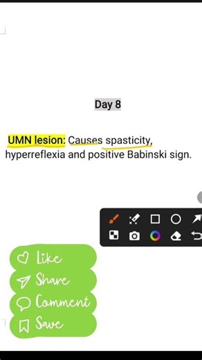 Signs of UMN Lesion | Neuro Viva
