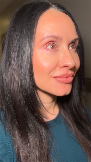 ✨ ONE WEEK post-SkinPen ✨ Jessica’s skin is already smoother, brighter, and glowing—proof that collagen remodeling is officially underway. SkinPen microneedling works beneath the surface to stimulate your body’s natural collagen production, improving texture, tone, and overall skin quality with results that continue to build over time. ✔ Brighter complexion ✔ Smoother texture ✔ Healthier skin overall Performed by Lyndsie at Spa Greystone 💫 This glow is just the beginning. 📞 Call 205-980-1744 e