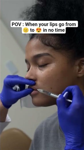 Enhance your lips with touch of volume and perfect hydration for a smooth, youthful look ✨#juvederm