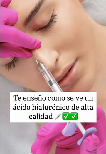 Rinomodelación con Ácido Hialurónico: Todo lo que Debes Saber