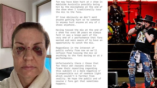 Adelaide Guns N' Roses fan hit by flying microphone