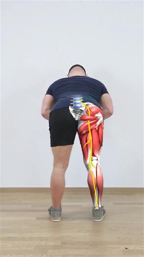 5.8K views · 86 reactions |  What Is Sciatica?  Sciatica is a type...
