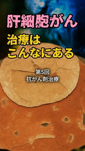 肝細胞がん、治療はこんなにある ⑤抗がん剤治療 #肝細胞癌 #分子標的薬 #免疫チェックポイント阻害薬 #テセントリク #アバスチン #ネクサバール #がん治療 #医療解説 #shorts