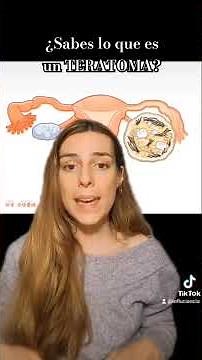 I explain what a teratoma is in the full video on my channel #teratoma #women'shealth #ovaries