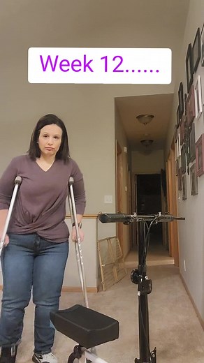 Ankle Surgery Recovery Journey: Progress Update