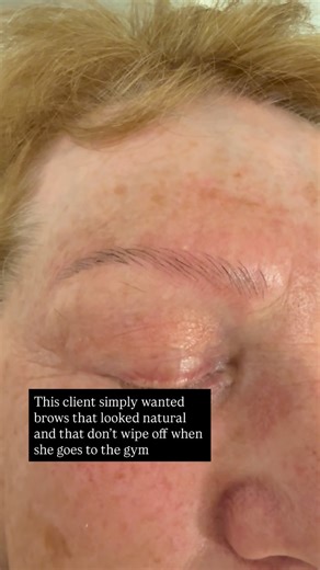 LONDON BROW CLINIC on Instagram: "Fresh and natural microblading by Galata at LondonBrowClinic. 5000 procedures carried out by Galata over 10 years. She works over the top of work by other artists too! £395 FIRST SET £195 TOP UP ON WORK BY ANOTHER ARTIST We are based on High St Kensington at The Royal Garden Hotel MediSpa BOOK BY CLICKING ON THE LINK We are London’s only microblading specialist clinic Medical pedigree 10 years of experience Microblading benefits women by providing a convenient a
