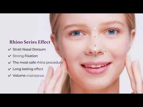 Meet the Next Generation of Thread Lifts: TESS