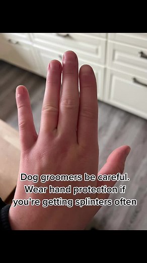 The pain was ridiculous. I couldn’t bend or straighten my hand. Thank god for the NHS, they were brilliant. First surgery was an emergency one as it started going septic. The second was done by a hand specialist and he has hopefully got it all out. I now wear latex gloves underneath thin gardening type gloves. 3 fingers out on both hands. My scar has healed nicely but I’m left with permanent holes in between my fingers where the hairs were getting in. #doggroomer #fyp #awareness #hairsplinters