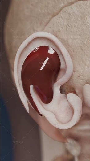 Was ist ein Otohämatom und wie beeinflusst es das Ohr?Entdecken Sie die Ohrenanatomie in 3D mit VOKA