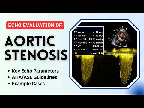 How to evaluate Aortic Stenosis by Echocardiography
