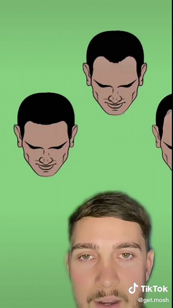 Understanding the Norwood Scale: Hair Loss Stages and Treatment Options