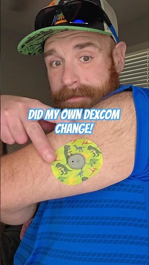 Doing my own Dexcom Change #diabetes #t1d #dexcom #dexcomstelo #dexcomchange #diabetestype1 #cgm