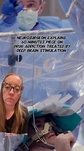 1.5M views · 1.8K reactions | Deep Brain Stimulation (DBS) involves surgery to place electrodes in your brain. It has shown early promise for treating substance use disorders. Here is my explanation on the @60minutes piece that aired a few days ago. #doctorexplains #neurosurgery #deepbrainstimulation | Dr. Betsy Grunch - Ladyspinedoc | Facebook