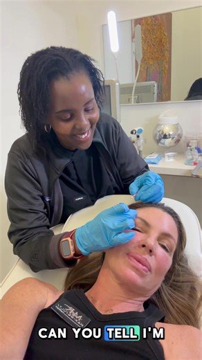 Let's talk about PDO threads It's super cool beauty treatment. Basically, PDO threads are these tiny, dissolvable threads made of polydioxanone (hence, PDO). They're used to lift and tighten your skin without the need for surgery. A skilled professional inserts the threads into your skin with a fine needle. Sounds a bit intense, but it’s usually done with local anesthesia like I show in the video. Once the threads are in place, they act as a support for your skin, encouraging collagen production