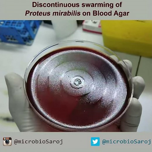 Swarming of Proteus mirabilis on Blood Agar