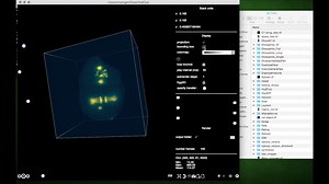 Spimagine – interactive GPU accelerated visualization and processing of time lapsed volumetric data