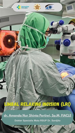 RESIDEN MATA UGM on Instagram: "Many cataract patients also have astigmatism (cylindrical vision)! Even after cataract surgery, blurry or double vision can persist due to uncorrected astigmatism. But there’s a solution! Introducing Limbal Relaxing Incisions (LRI), a technique that can correct astigmatism during cataract surgery for sharper vision. Performed by expert dr. Amanda Nur Shinta Pertiwi, Sp.M, LRI helps flatten the cornea to improve focus and enhance visual outcomes. ✔️ Alternative if 