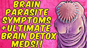 Brain Parasite Symptoms The Ultimate Brain Parasite Detox Meds!