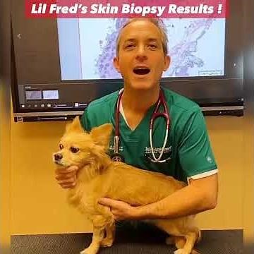 Sebaceous Adenitis diagnosed with High Power Laser Skin Biopsies !