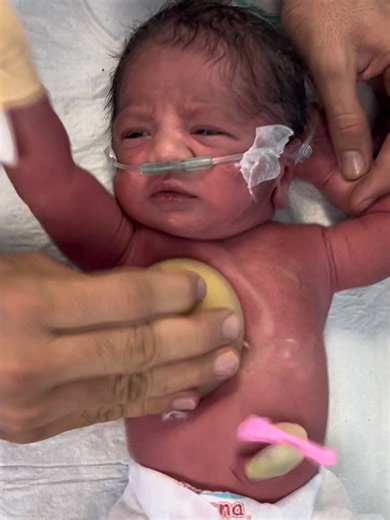 Understanding Newborn Cyanosis: Causes and Concerns