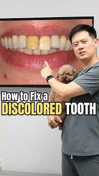 Why Is My Tooth Turning Dark? Discolored Tooth Treatment Options at W Plus Dental in Washington DC