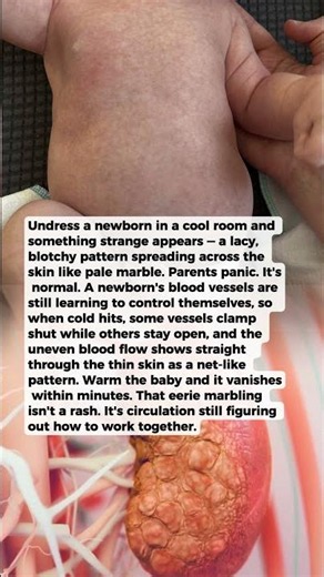 Why a Newborn's Skin Turns Marbled and Patchy in the Cold