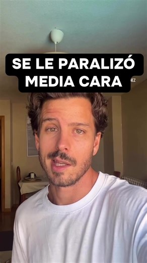 MEDIA CARA NO LE RESPONDE - PARÁLISIS FACIAL DE BELL Caída de la comisura, sonrisa asimétrica, dificultad para cerrar el ojo… Podría ser parálisis facial. A propósito del caso de Carlos Jiménez, te explico qué es, por qué ocurre y cómo actuar. Y otro caso mediático: el síndrome de Ramsay Hunt (otra causa de parálisis facial) fue lo que comunicó Justin Bieber en 2022. • Síntomas: asimetría facial, lagrimeo/sequedad ocular, alteraciones del habla. • Alerta ictus: si aparece debilidad en brazo/pier