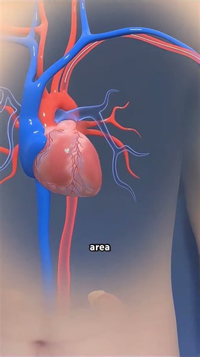 How Rotational Atherectomy Is Done? (3D Animation) #structuralheart #aorticvalvestenosis