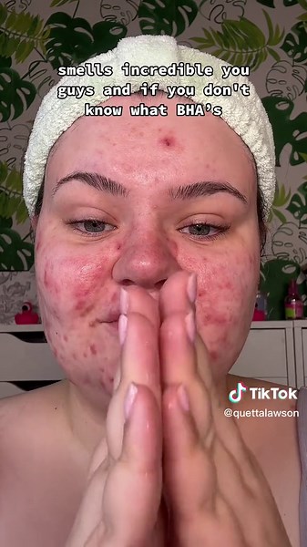 Glow Recipe Skincare: Fruit Babies Set Review & Usage Guide