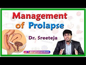 Management of Prolapse || obstetrics & gynecology