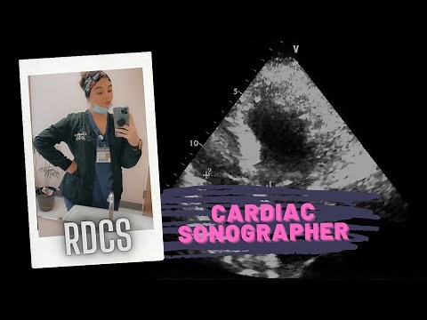 Life of a Registered Diagnostic Cardiac Sonographer | Echocardiography