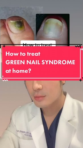 Green Nail Syndrome Treatment at Home | Pseudomonas Guide