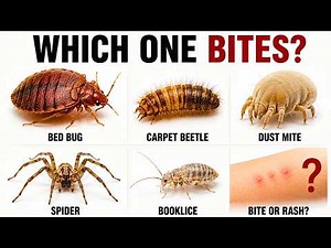 Bed Bug Bites Explained: 5 Bedroom Bugs Compared 🛏️