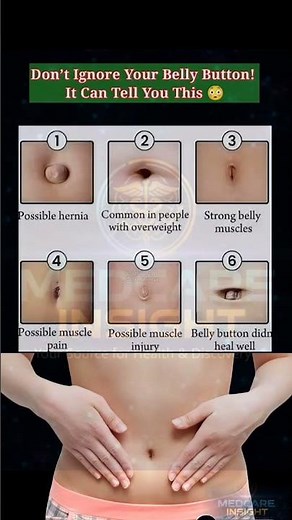 Types of Belly Buttons and What They Mean | Medical Facts