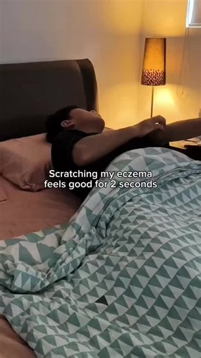 when you start scratching non-stop 😨 #eczema #scratching #eczemapain #eczemaflareup #eczemawarrior