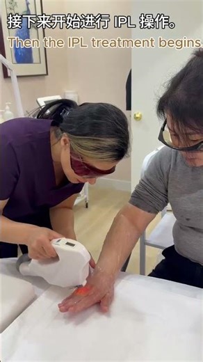 IPL Hand Rejuvenation Treatment
