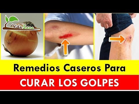 How to Heal Bruises and Wounds with Home Remedies - Healthy Living