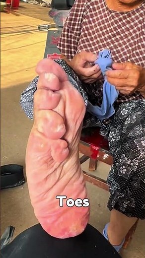 The Painful History of “Lotus Feet”