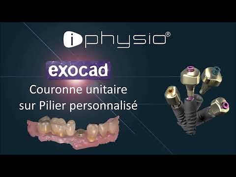TUTORIEL EXOCAD// Pilier personnalisé _ iPhysio®